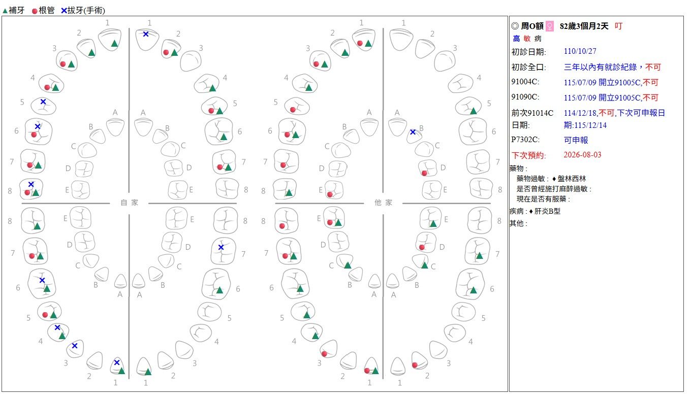 全口牙位圖:補牙、根管、拔牙處置紀錄完整呈現